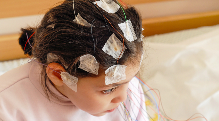 como-se-puede-prevenir-la-epilepsia