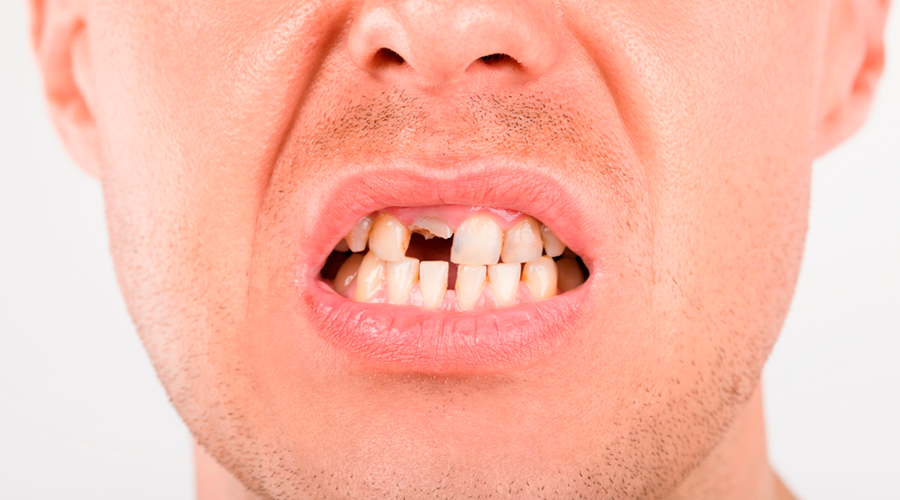 Problemas dentales o de higiene bucal